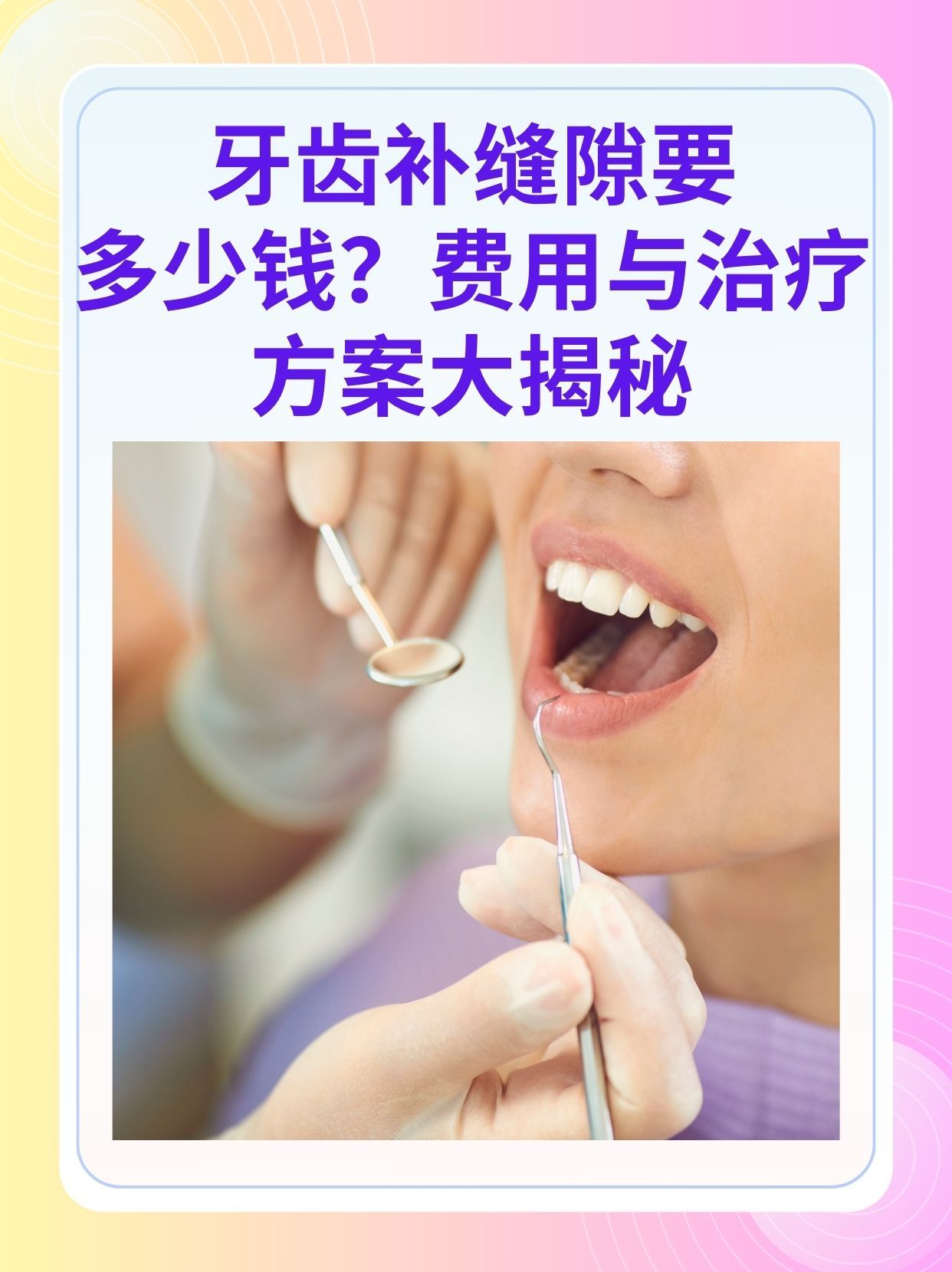 绵阳补牙医保可以报销吗(补牙医保可以报销吗 哪些可以报销呢)